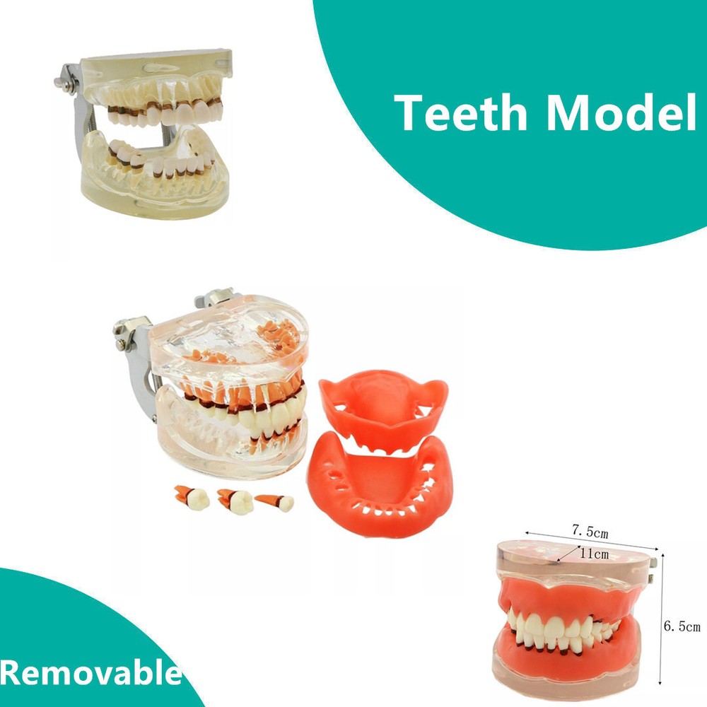 Dental Teeth Model Pathological Disease M4017 Removable Teaching Study Model