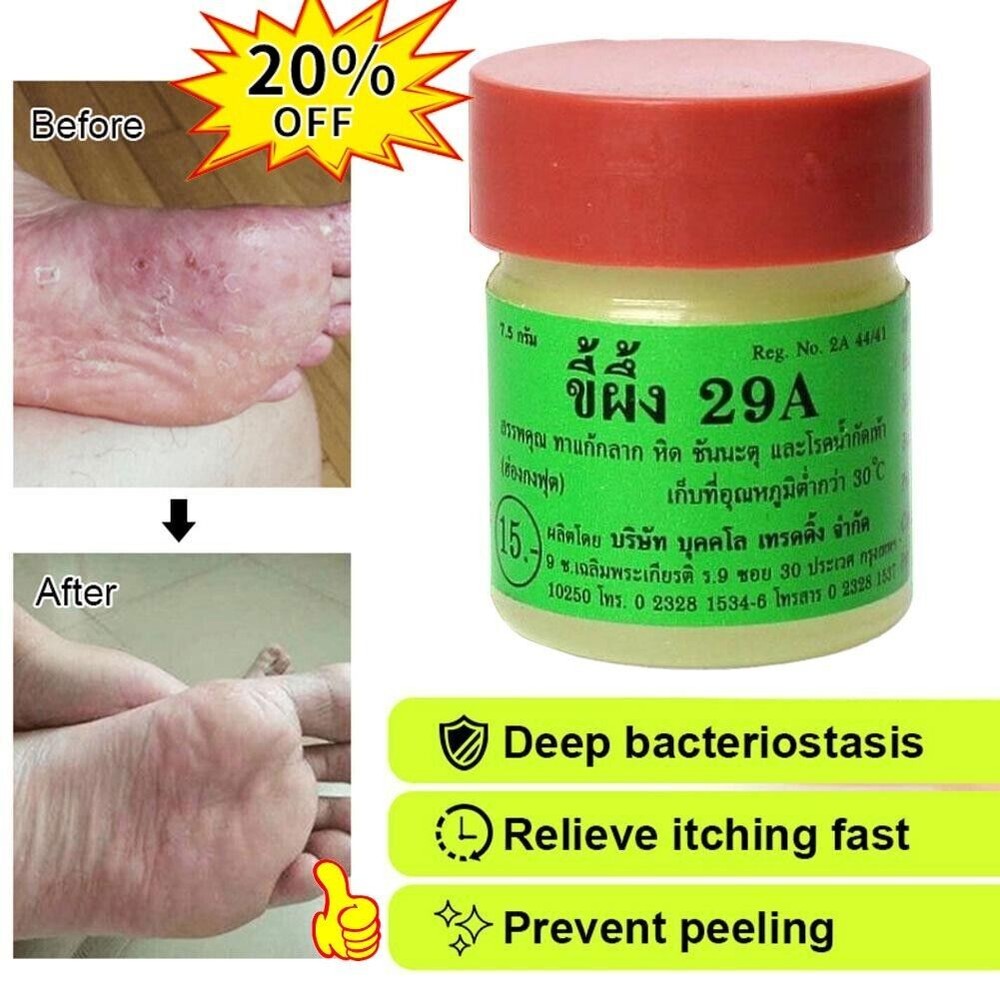 Relief Athlete's Foot Antifungal New H0O7