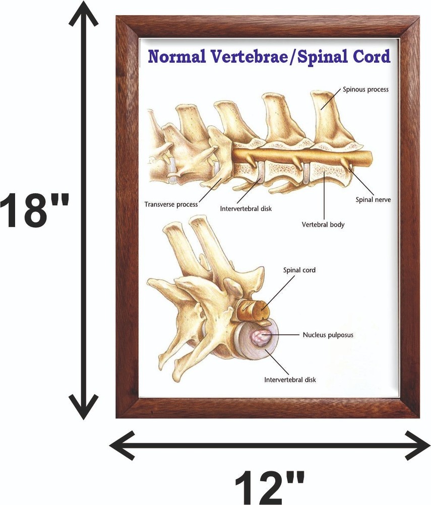 Normal Vertebrae/Spinal Cord Chart 12x18 inches