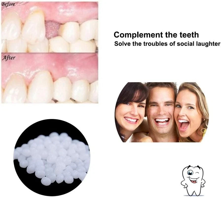 3 Colors Temporary Moldable False Teeth Repair Replacement Thermal Fitting...