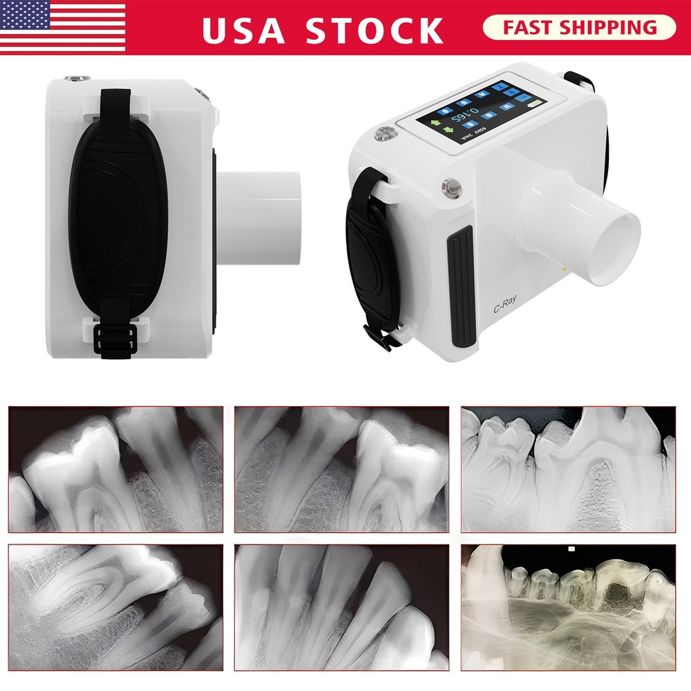 Dental X Mobile Rays Digital Machine Rayos Without Shield RX