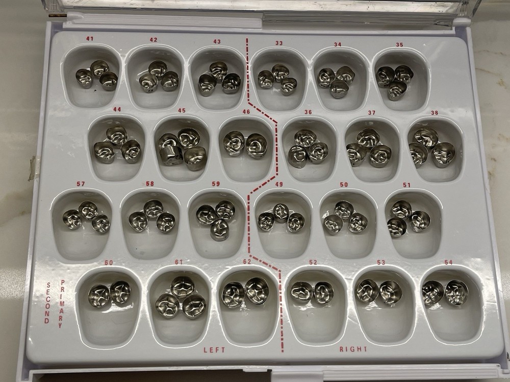 Second Primary Molar Crowns by Rugby Labs
