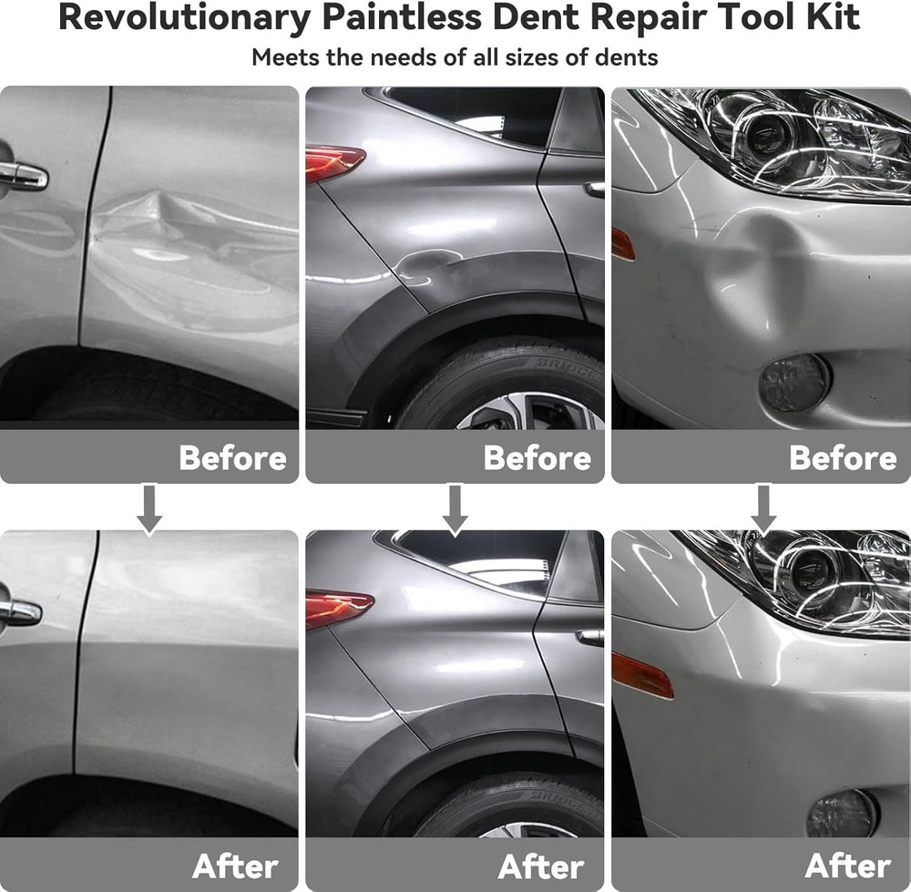 Professional Dent Removal Kit - Paint-Safe & Effective