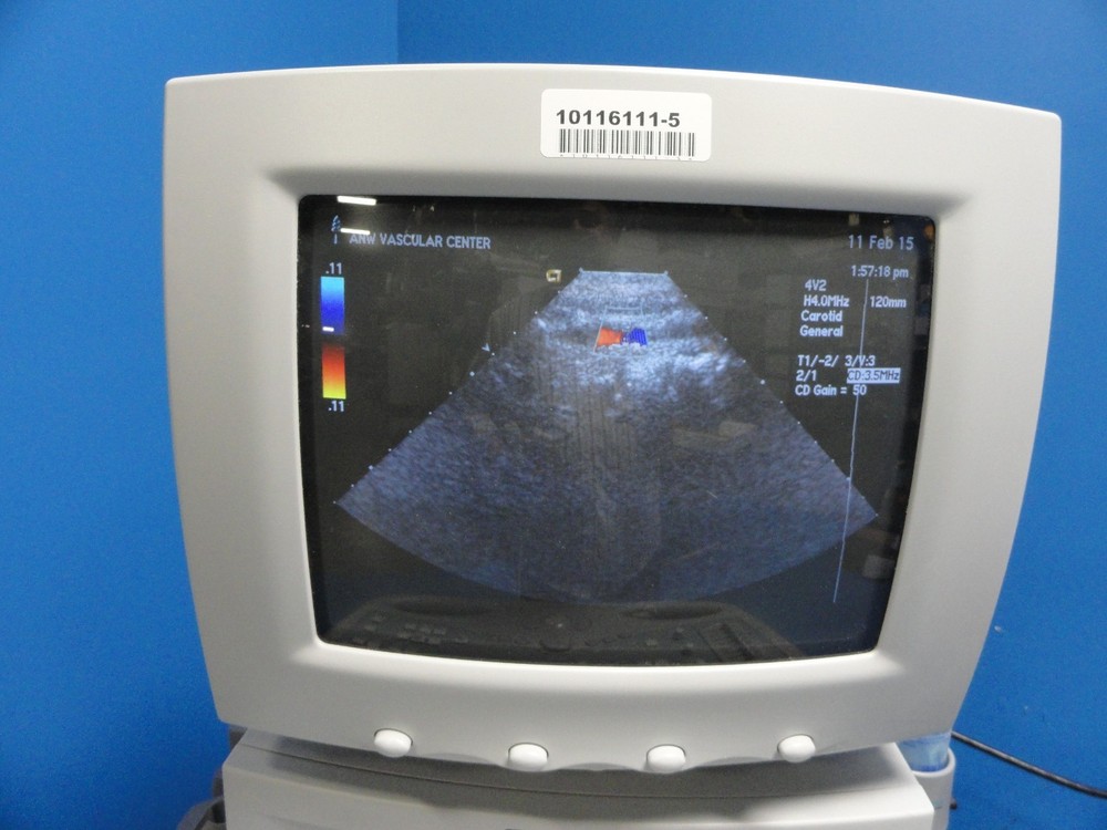 Siemens Acuson 4V2 Vector Array Ultrasound Probe – For Sequoia Series ~ 8584