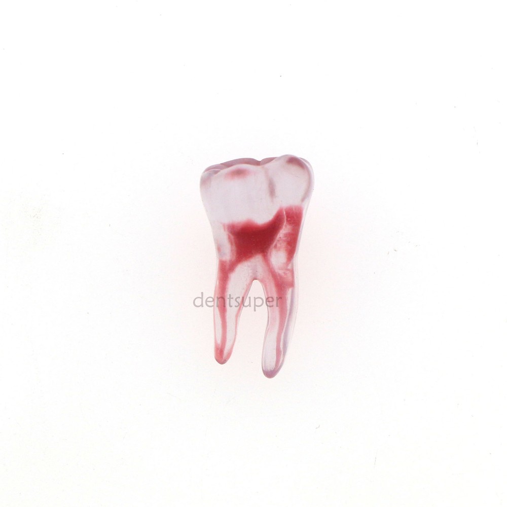 Dental Endo Root Canal Teeth Model Practice Block for RCT Pulp Cavity Study, 3D