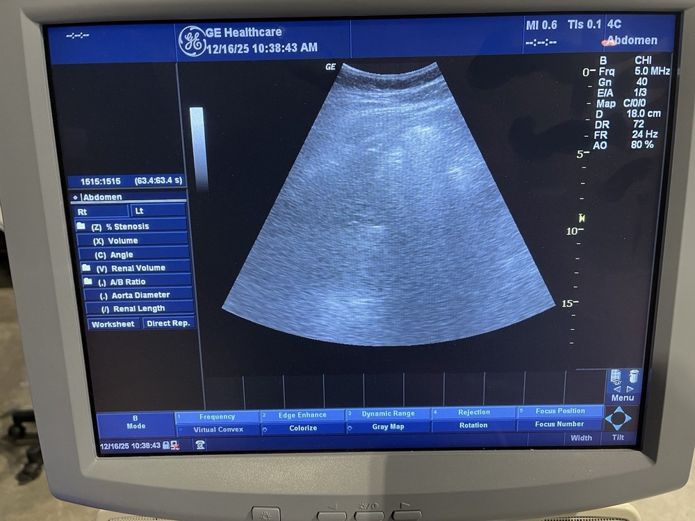 GE 4C Convex Array Ultrasound Transducer Probe -