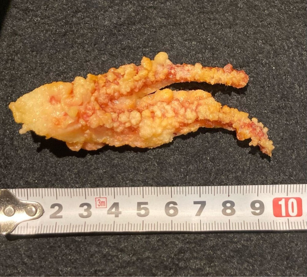 Food sample: Fried squid tentacles
