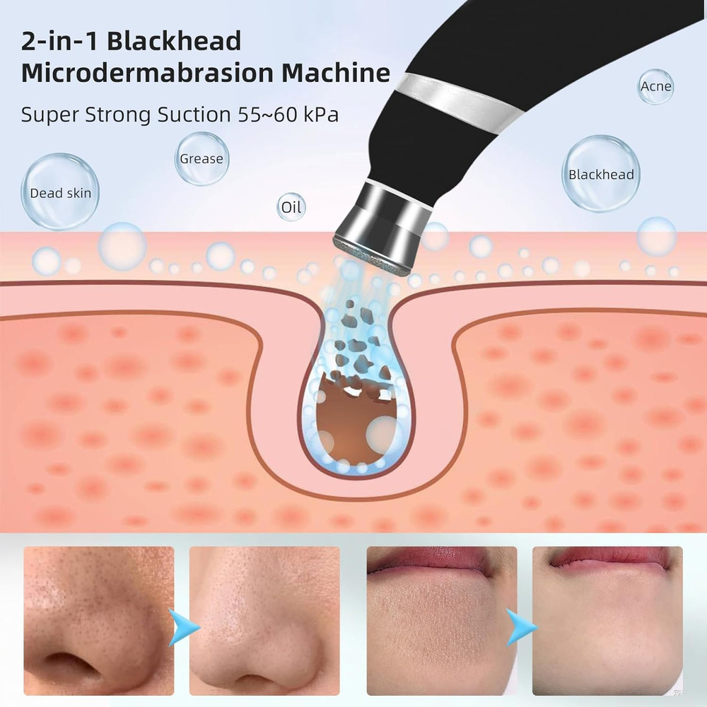 Diamond Microdermabrasion Machine, 3 Modes Diamond Microdermabrasion Dermabrasio