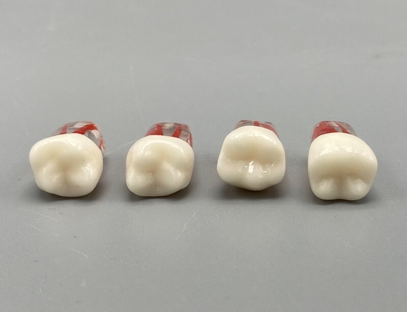 5pcs Dental Root Canal Teeth Study Practice Model Endodontic RCT Endo Pulp File