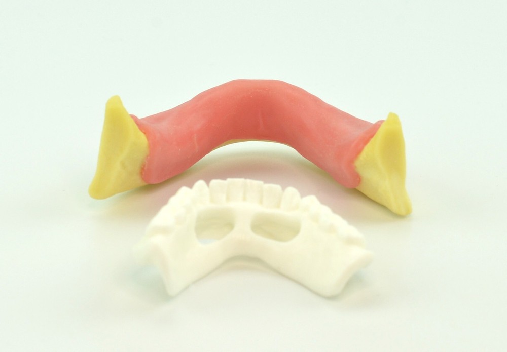 Dental Mandibular Implant Plus Denture Training Model Implant Placement