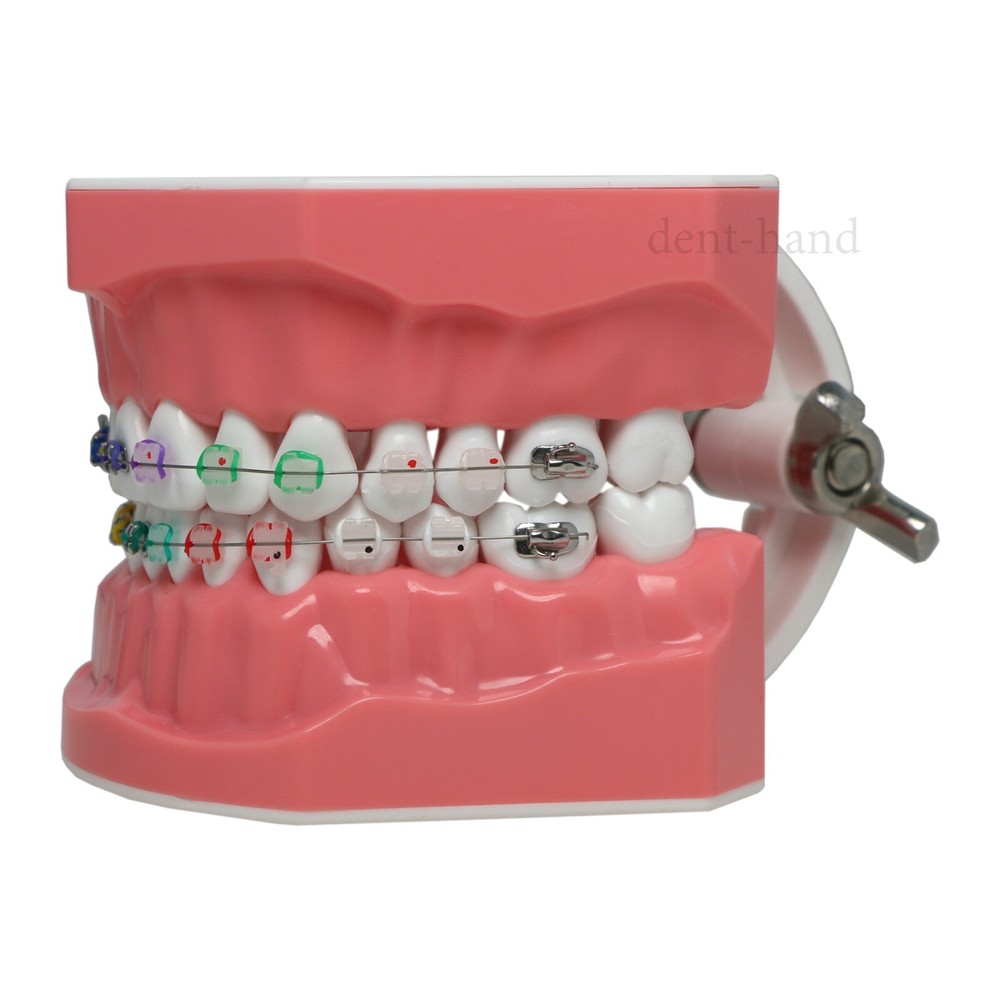 Dental Typodont Teeth Model 1:1 Teach Study Half Metal Ceramic Brackets Tubes