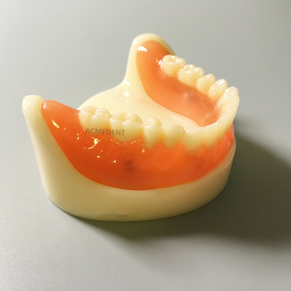 Dental Full Denture Model Overdenture Magnetic Attachment Mandibular +Upper