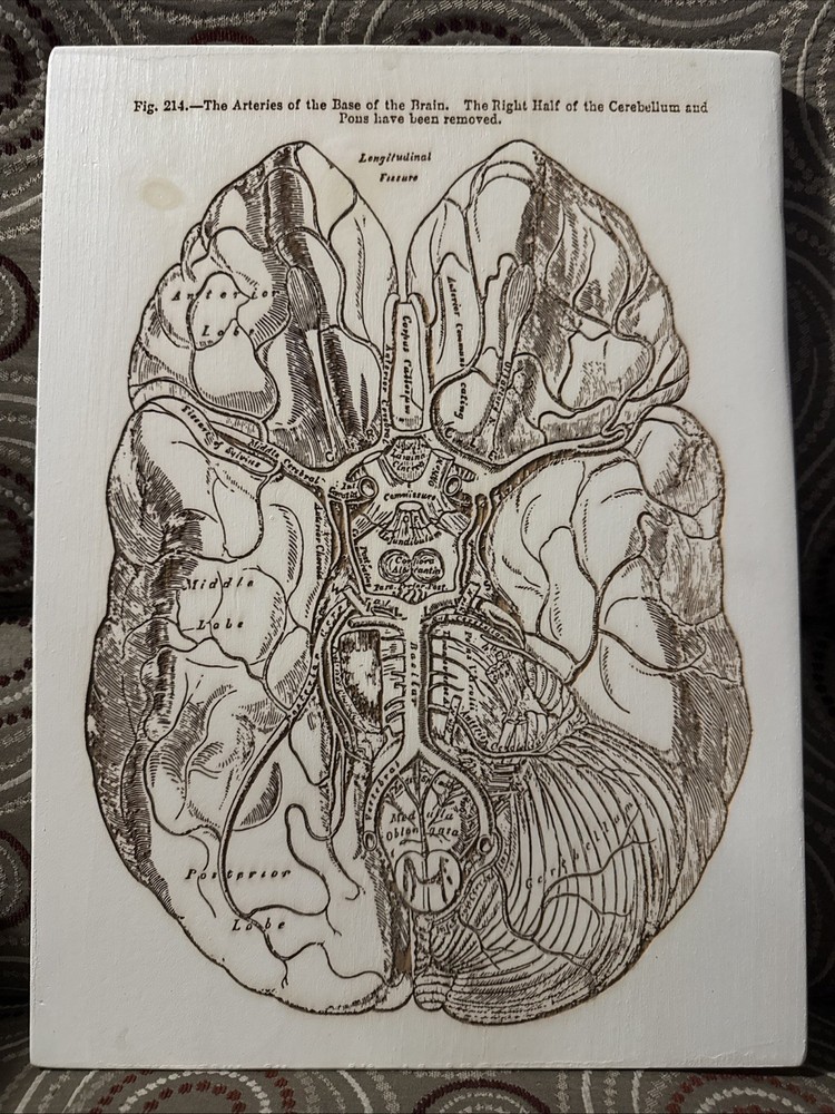 Fire & Pine Grey’s Anwtomy Brain  Wood Burnt Decor Artwork