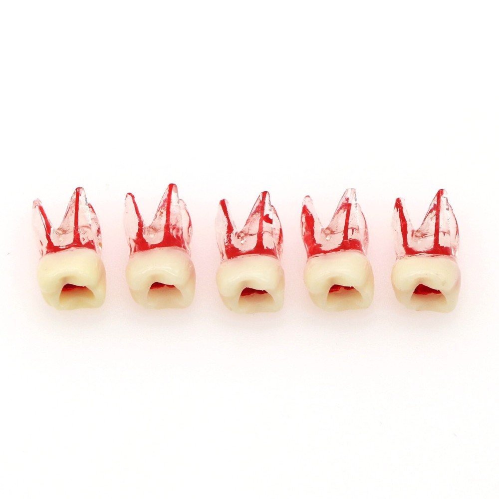 Dental Molar Endo Root Canal Teeth Modle- Study RCT Practice Block Pulp Cavity