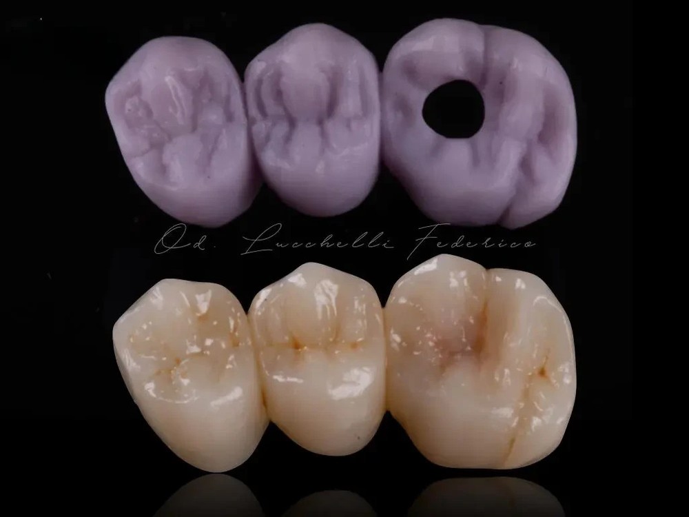 CEREC® Blocks Lithium Disilicate x5