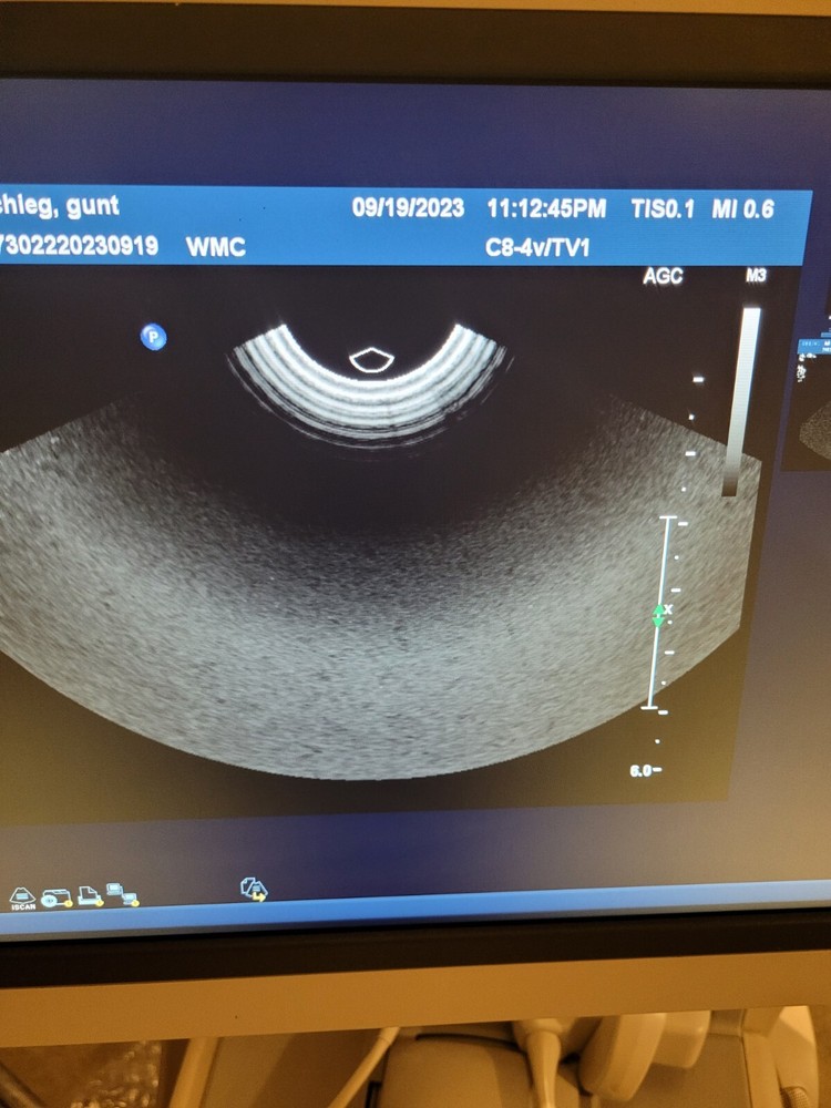 Philips C8-4V Endocavitary Transvaginal Probe 