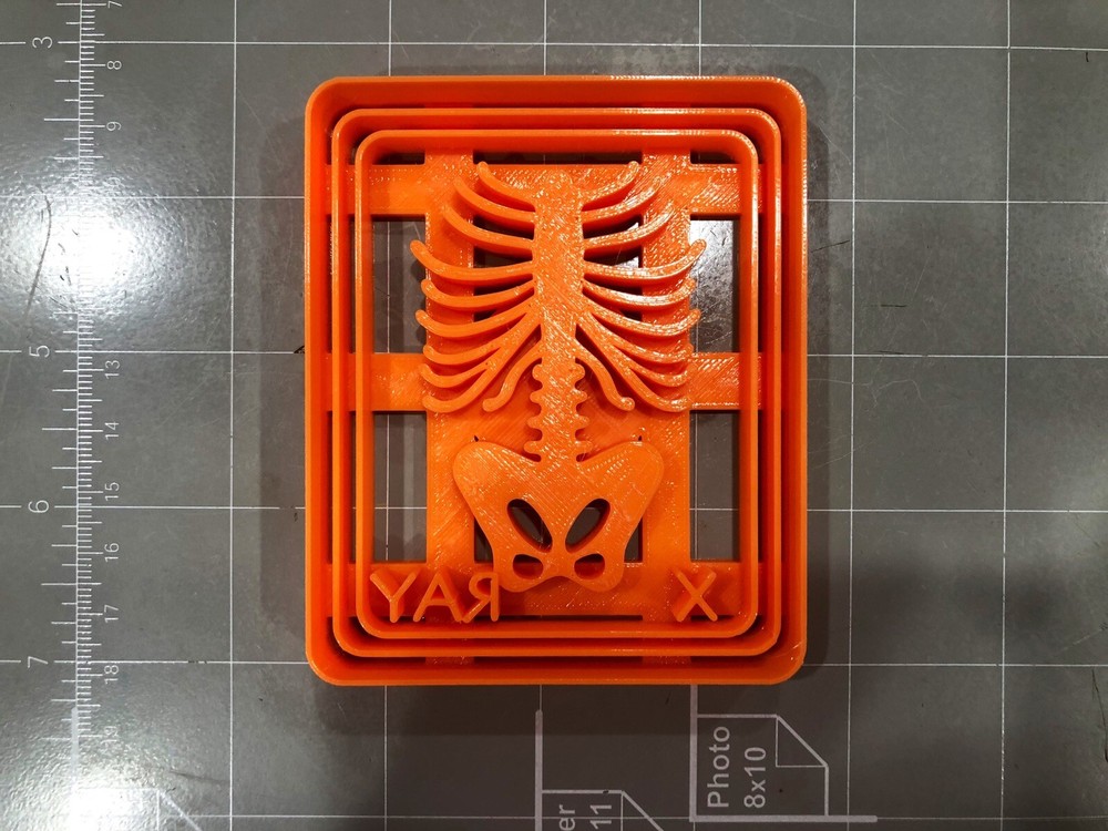 X-ray Cookie Cutter