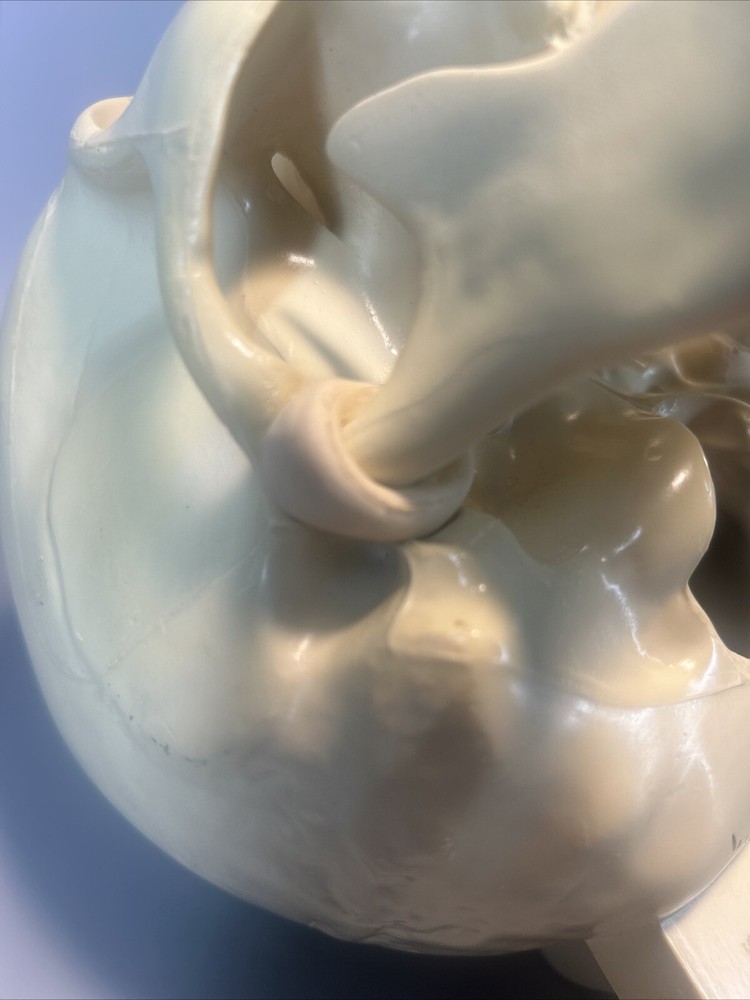 Synbone, Human Skull, Surgical, Training, Education,