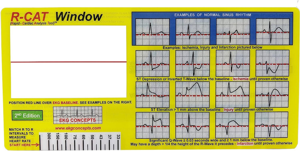 EKG Window 2Nd Edition