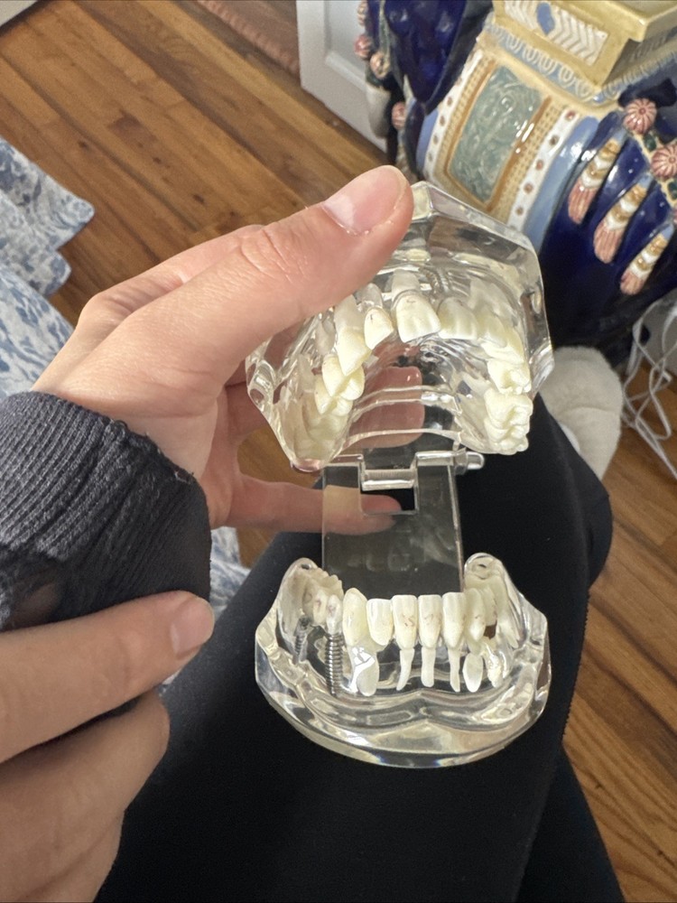Dental Typodont Model