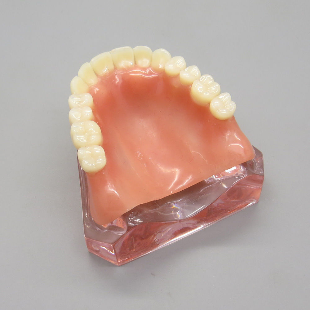 Dental Implant Teeth Model Demo Overdenture Restoration Teaching Study 4 Models