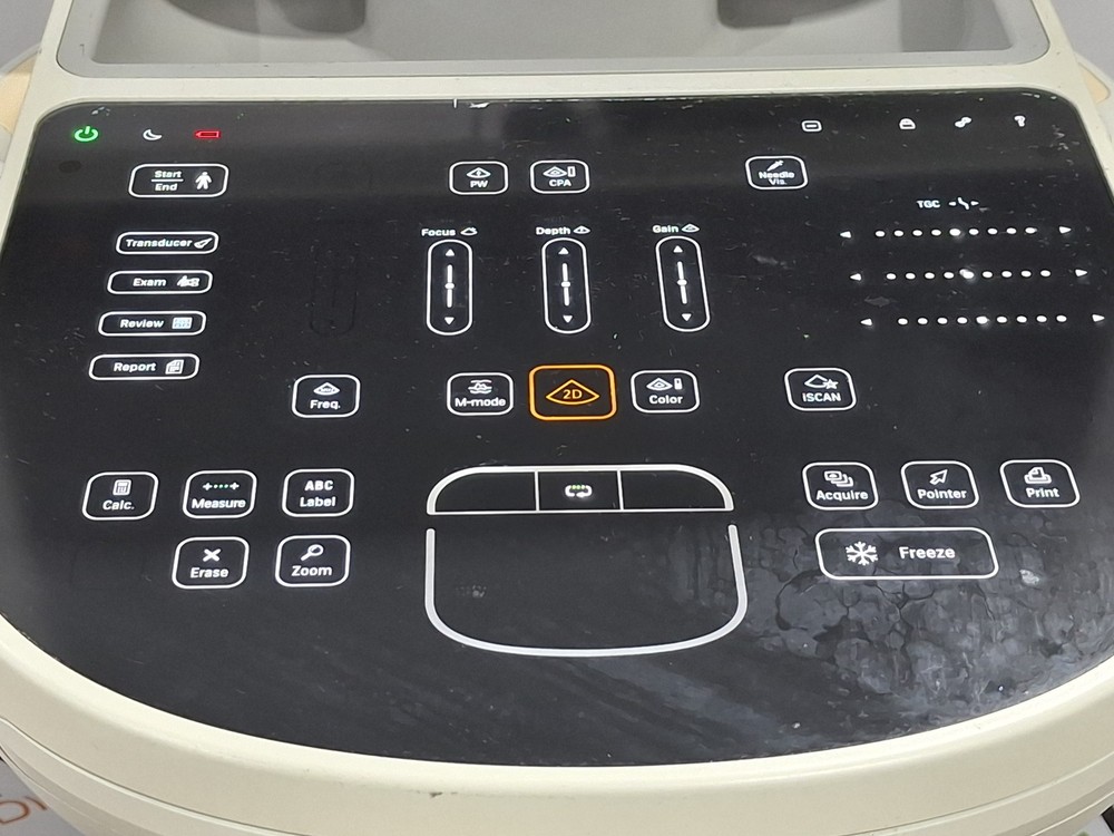 Philips Sparq Ultrasound System