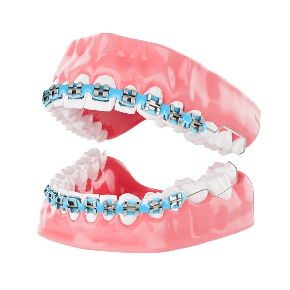 4 Pair of Temporary Tooth Decoration, Teeth Retainer Practical Brackets para ...