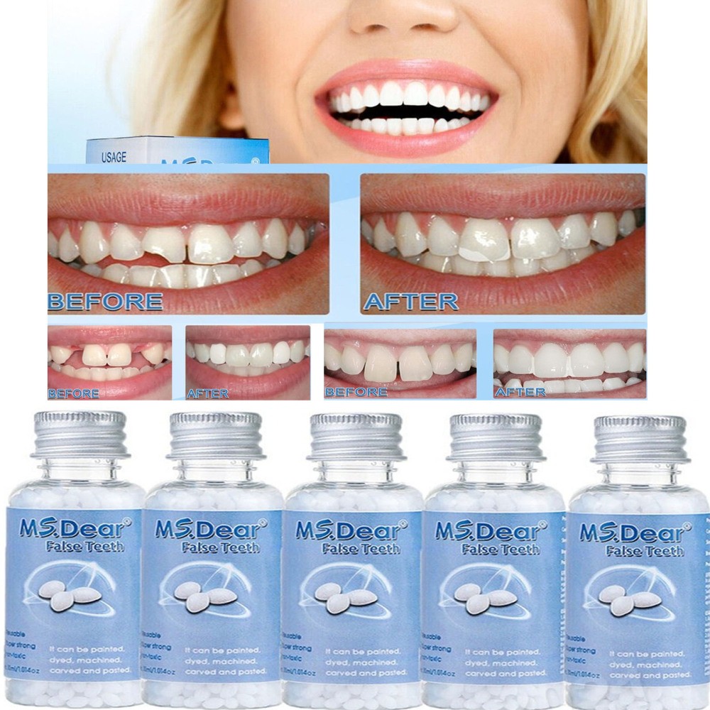 1-5X Tooth Repair Granules Temporary Fitting Beads Reusable Moldable False Teeth