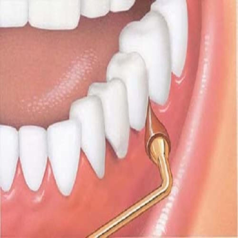 Stimulator Permanent Handle - 1 Rubber Tip Included - Long Handled Massager Remo