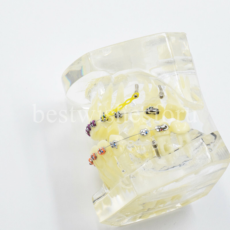 Dental Malocclusion Treatment Teeth Model Study Typodont Elastic chain 3005-2