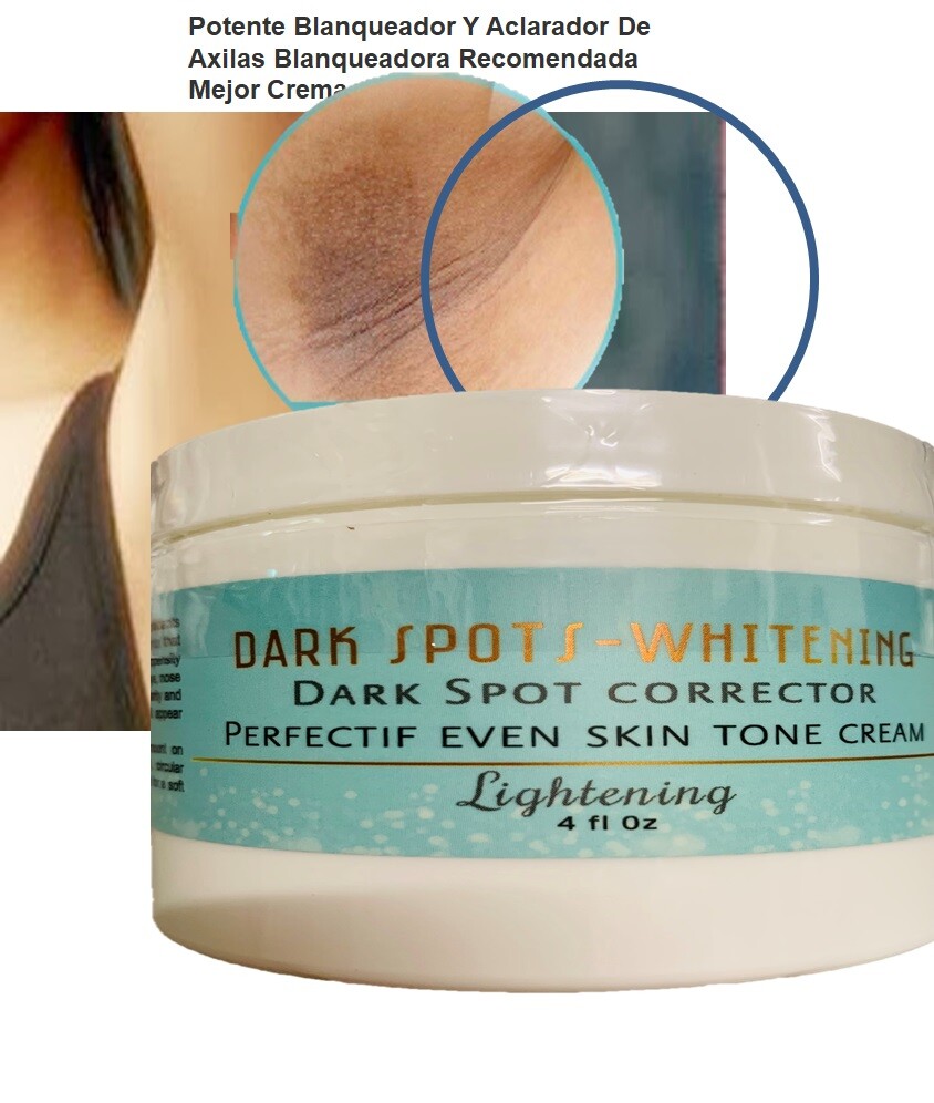 Dark Spot Cream 4oz Spot Corrector Remover support Face Lightening