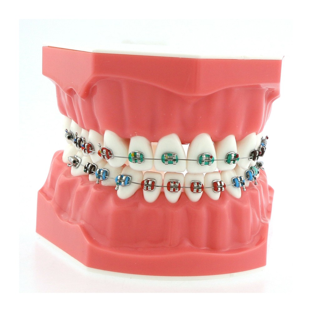 US Dental Typodont Demonstration Teach Teeth Model with Braces For Patient Study