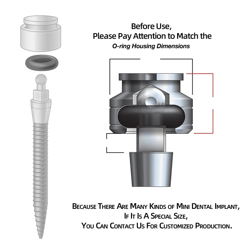 O-Ring Replacement Kit with 36 Durable Buna-N Sizes for Dental Implants