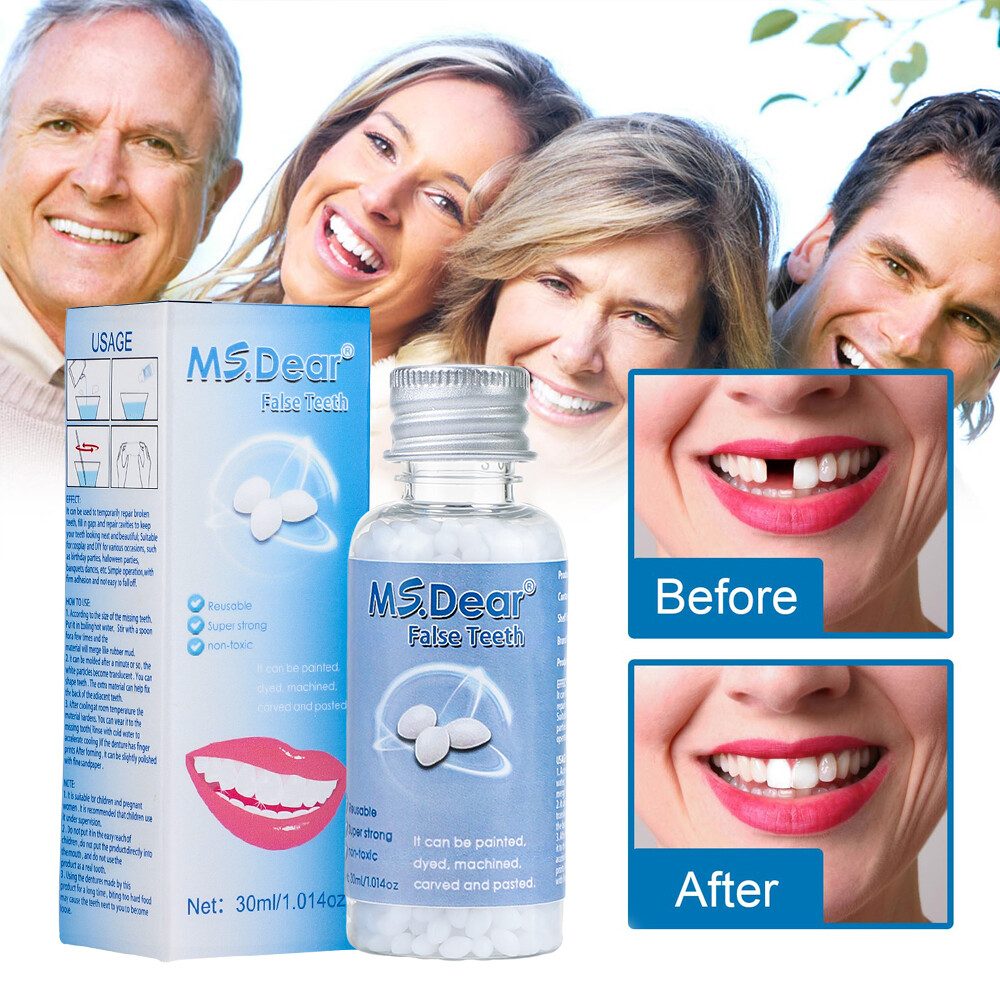 Tooth Solid Gel Temporary Repair Kit Moldable Thermal Fitting Bead Teeth 30ml