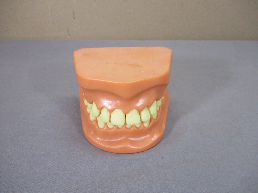 Dentist Typodont Dentoform Dental Model Teeth Overbite Tooth Display Hinged Set