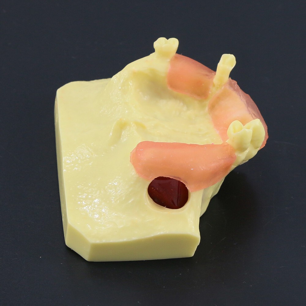 Dental Typodont Teeth Model Sinus Lift Practice Study Teach Demo Model 2012 2013