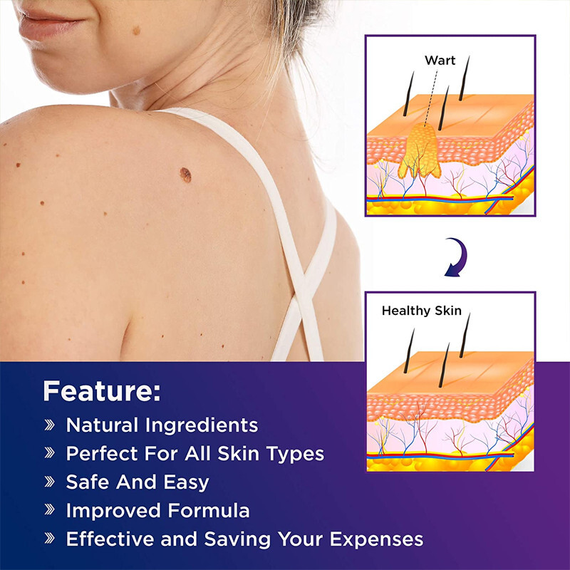 3Pack Wart Remover Liquid Skin Tag Mole Remover Eliminate Feet Corn Wart Remove