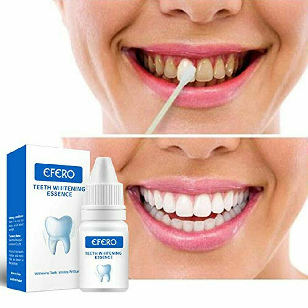 3PCS Whitening Teeth Bleach Gel Instant Whiter Advanced Bleaching White Stained