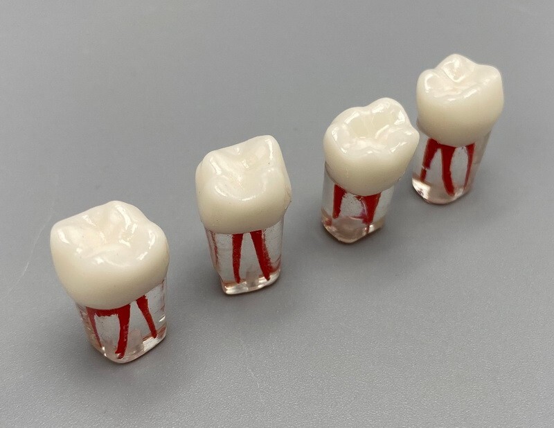 5pcs Dental Root Canal Teeth Study Practice Model Endodontic RCT Endo Pulp File