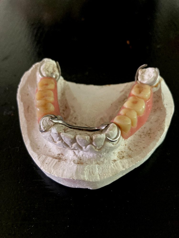 Dental Bridge Plate Training Aid