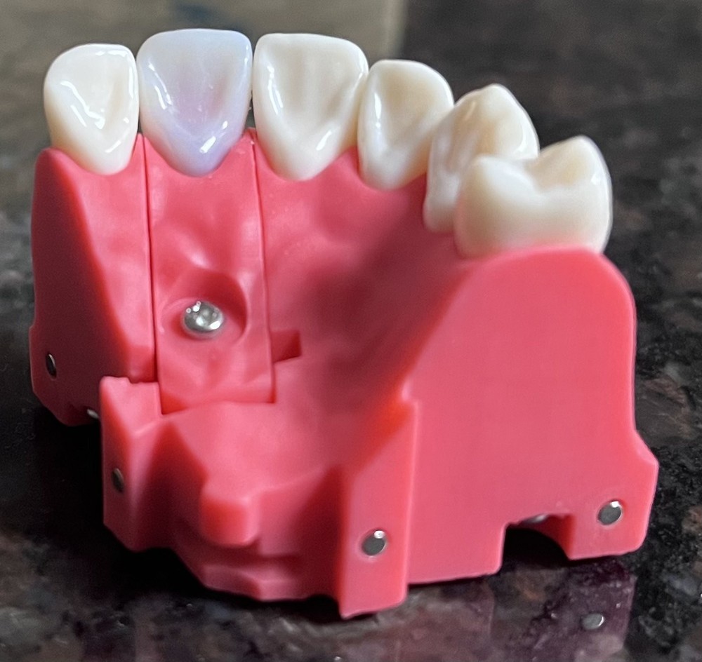 Kilgore ADEX Endo Typodont Tooth #8 Practice
