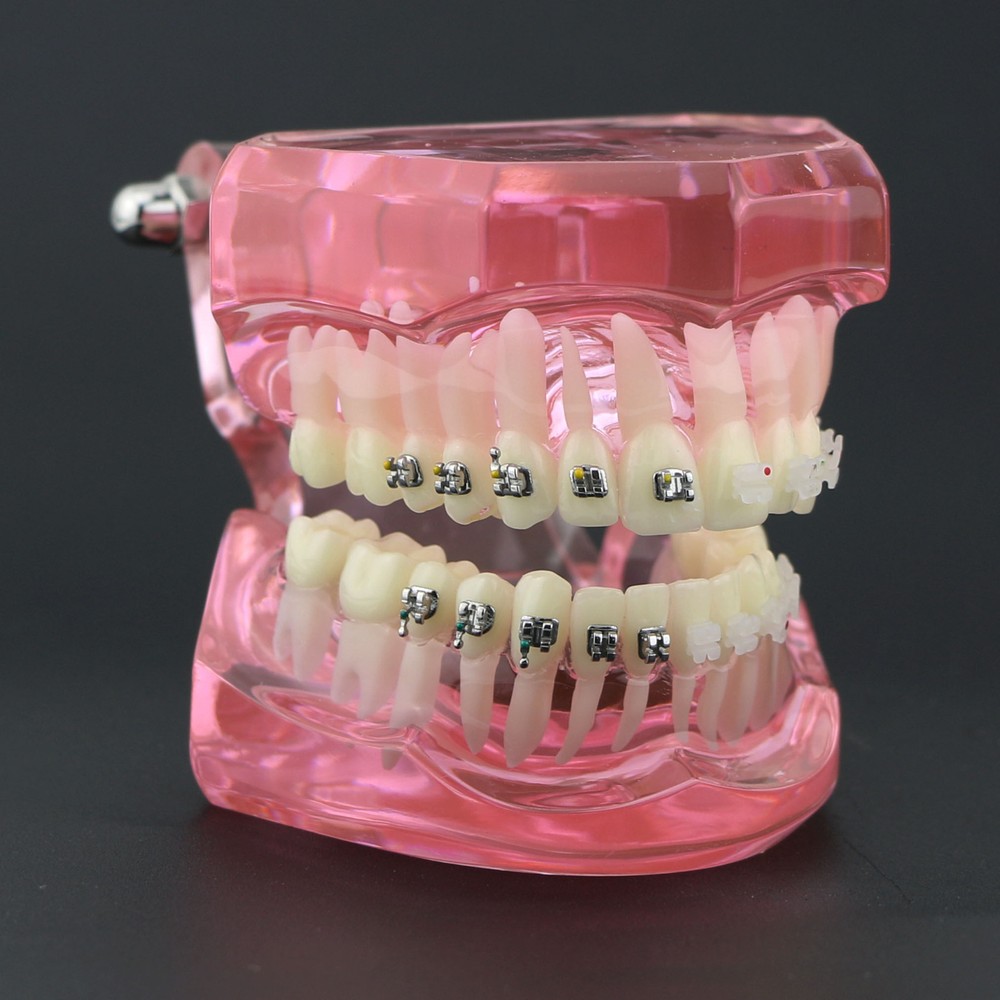 Dental Orthodontic Teeth Model Metal and Ceramic Bracket Study Teach Model 3003