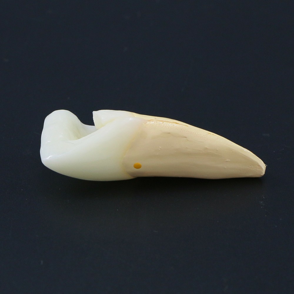 Endodontic Treatment Root Canal Tooth Teach Study Dental Teeth Removable Model