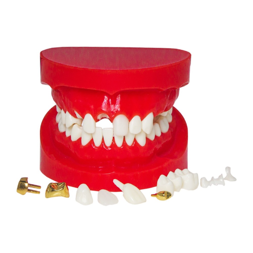 Dental Teaching Typodont Teeth Restoration Model Crown Post Core Bridge M6004