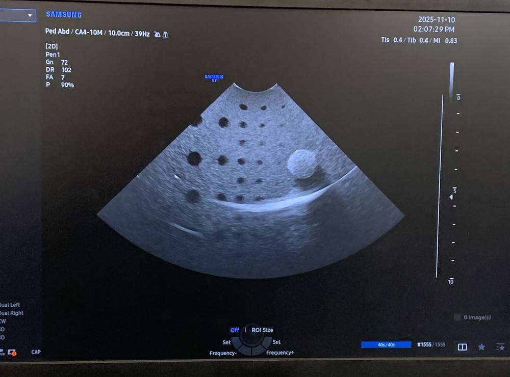 Samsung CA4-10M Micro Curved Array Ultrasound Probe, YOM: 2023