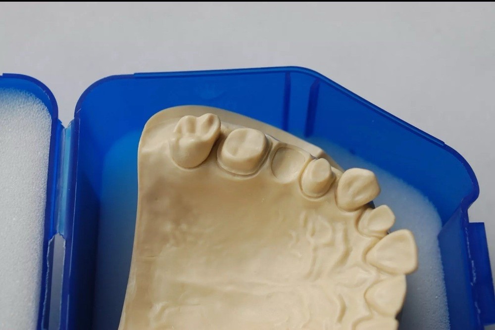 IVOCLAR TEST MODEL - CEREC Scanning -