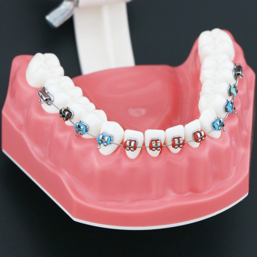 Dental Teach Typodont Demonstration Teeth Model with Brackets Patient N5006