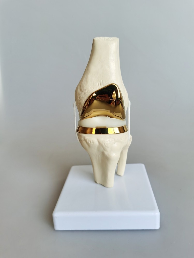 Detachable Knee Prosthesis Medical Anatomical Teaching Display Model Display