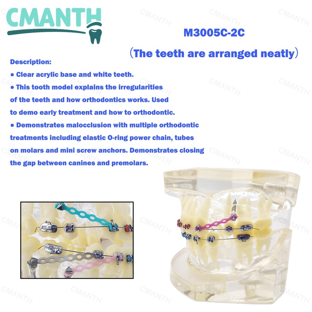 Dental Model Ceramic Brackets Orthodontic Correction Teaching Model M3005