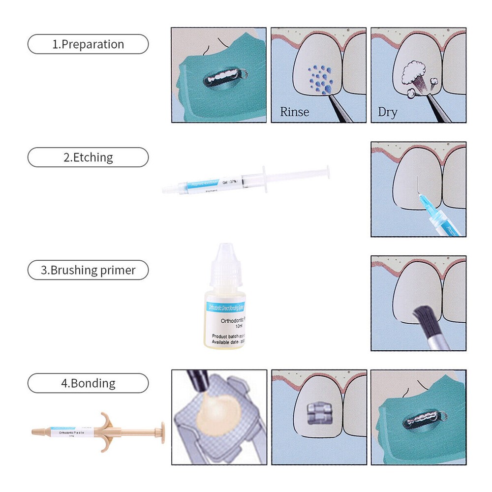 Dental Orthodontic Direct Paste Adhesive Bonding Self Curing Composite Resin Kit